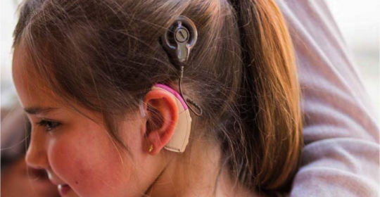 Gracias al Implante Coclear las personas que no podrían oír, ahora oirán